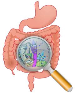 Ulcerozni kolitis in probiotiki